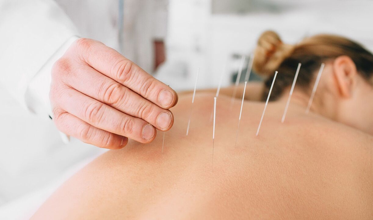 Acupuncture for smoking cessation